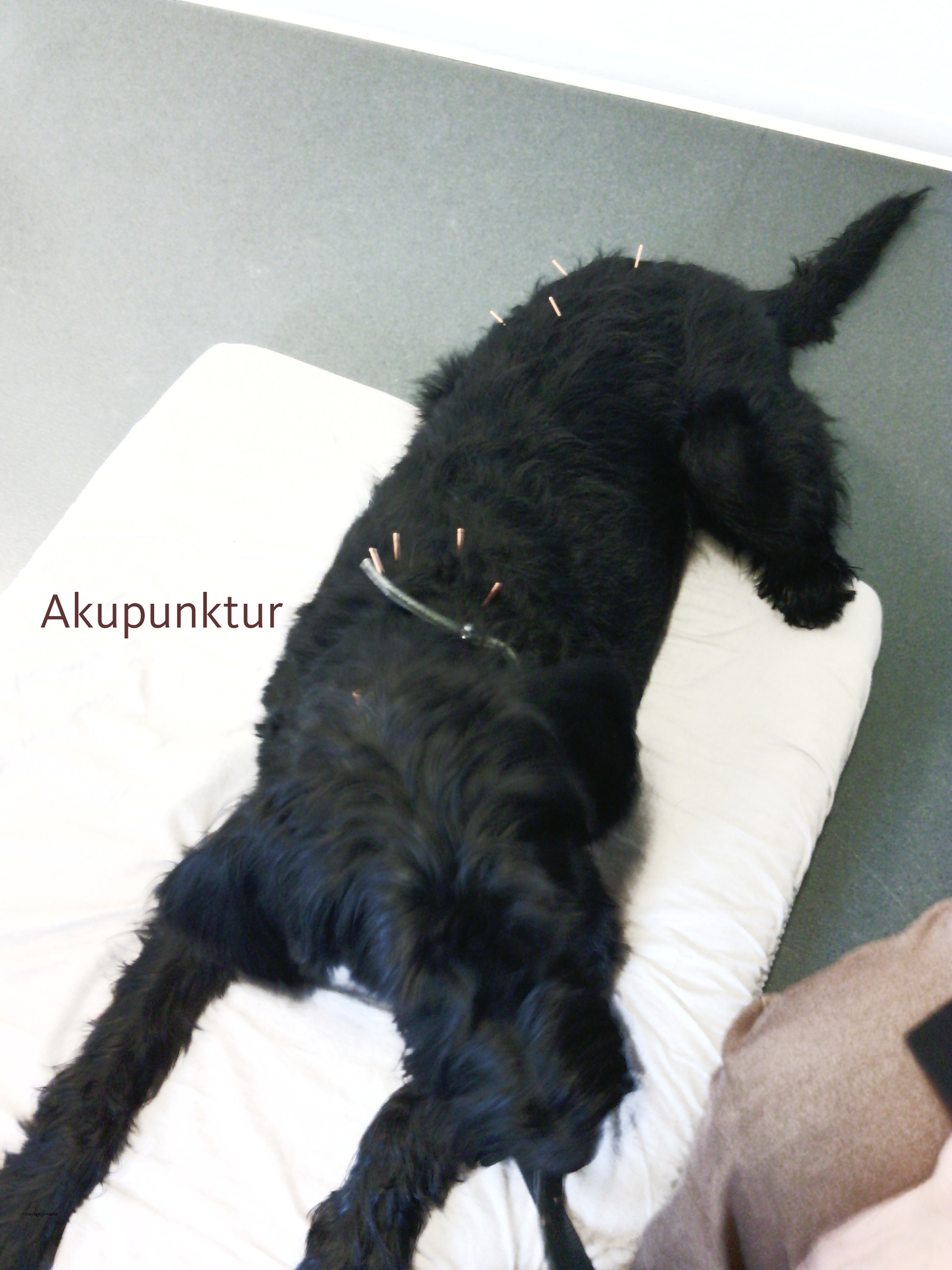 Akkupunktur